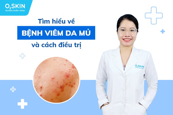 Tìm hiểu về bệnh viêm da mủ và cách điều trị