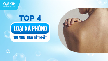 Top 4 loại xà phòng trị mụn lưng tốt nhất