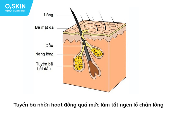 Mỗi loại xà phòng sẽ có những công dụng khác nhau đối với từng làn da