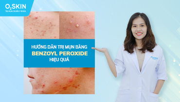 Benzoyl Peroxide - Hoạt chất vàng trong điều trị mụn trứng cá