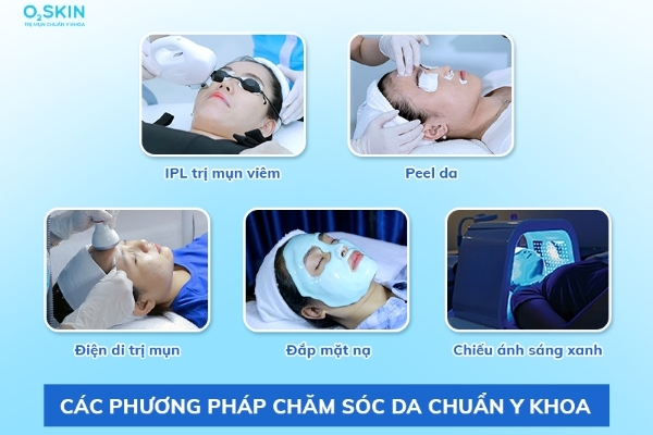 Cách xử lý mụn viêm