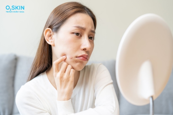 Mụn bọc bao lâu thì hết