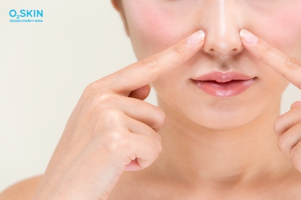 Vị trí mụn ẩn dưới da