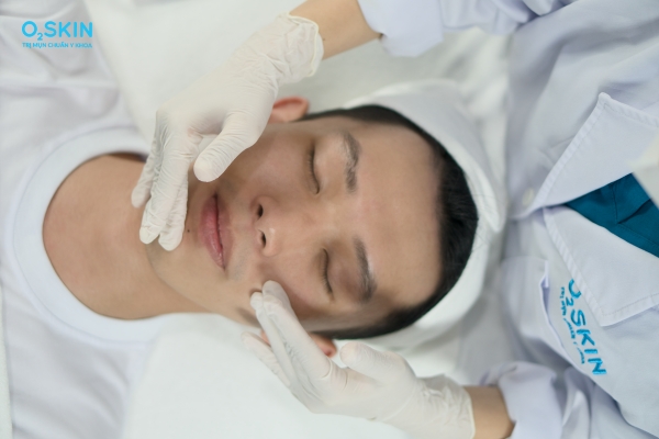 Có nên peel da tại nhà không