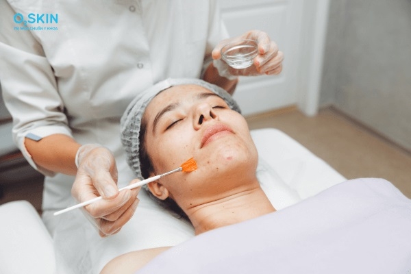 Công dụng của peel da