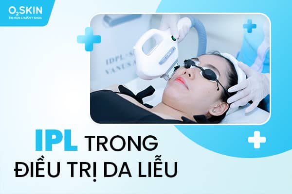 IPL trong điều trị da liễu