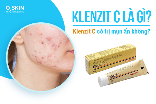 Klenzitc C trị mụn gì? Klenzit C có trị mụn ẩn không?