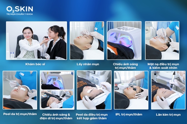 Mụn mọc nhiều ở cằm phải làm sao