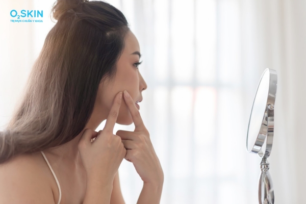 Nặn mụn đầu đen sợi bã nhờn