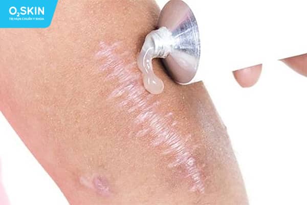 Stratamed dưới dạng gel khi khô tạo thành một lớp bảo vệ mỏng