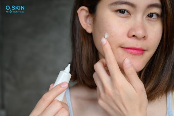 Thuốc bôi trị mụn đầu đen to