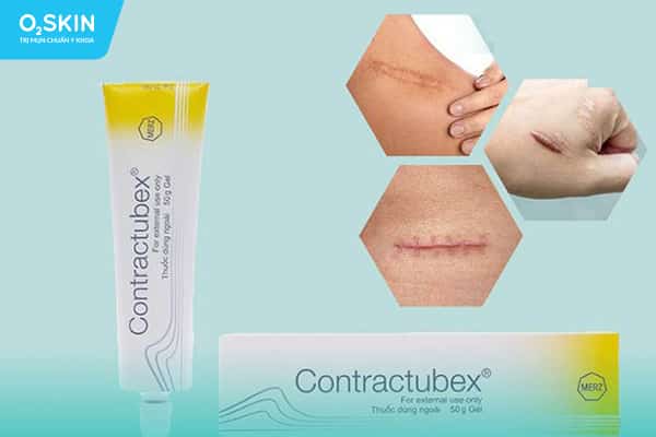 Contractubex có hiệu quả điều trị cao với hầu hế