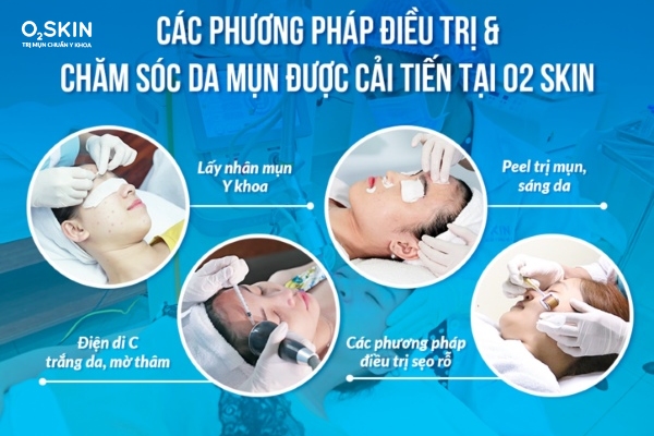 Điều trị mụn trứng cá chuẩn y khoa
