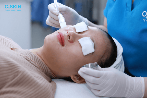 Mụn đầu đen không nặn có tự hết không