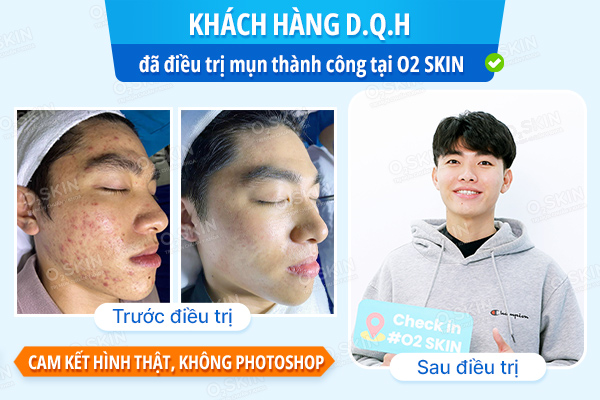 Khách hàng Dương Quốc Hy