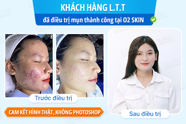 Khách hàng Lê Thị Tiên