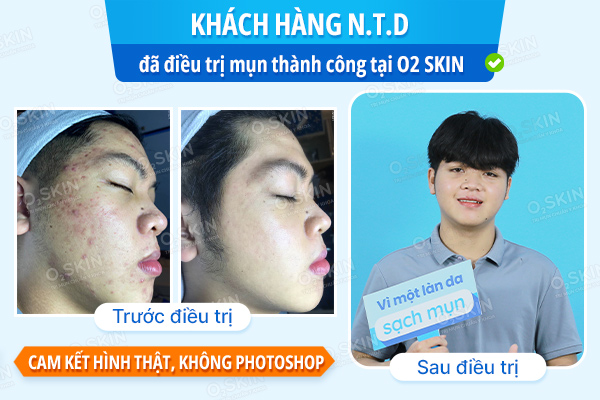 Khách hàng Nguyễn Tấn Dũng