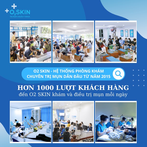 Khám mụn tại O2 SKIN