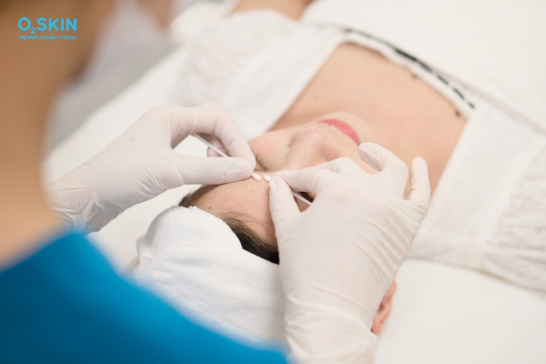 Cách trị mụn li ti