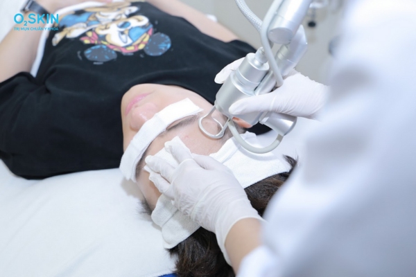 Laser trị sẹo đáy tròn