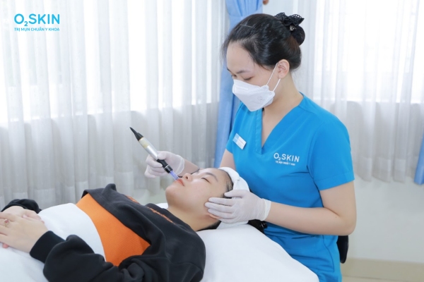 Lăn kim chuẩn y khoa tại O2SKIN