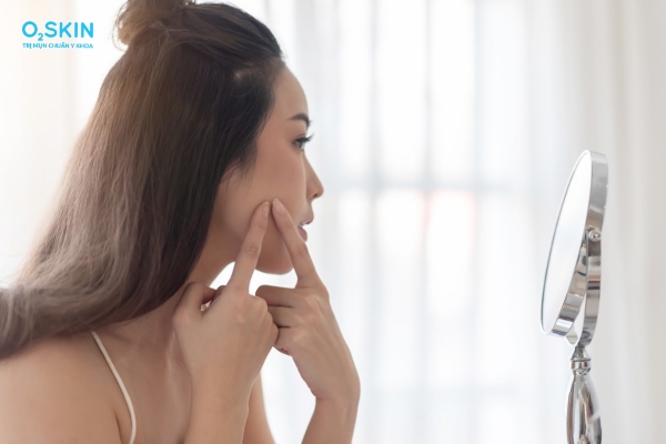 Nguyên nhân bị mụn đầu đen ở má