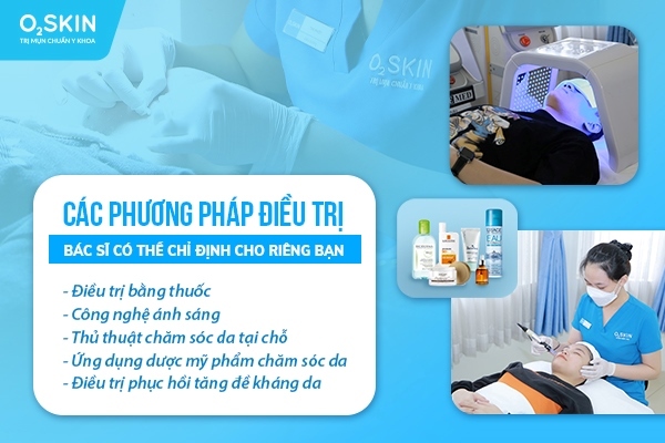 Phác đồ điều trị mụn trứng cá chuẩn y khoa