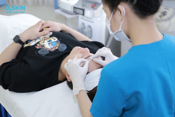 Cách nặn mụn trứng cá