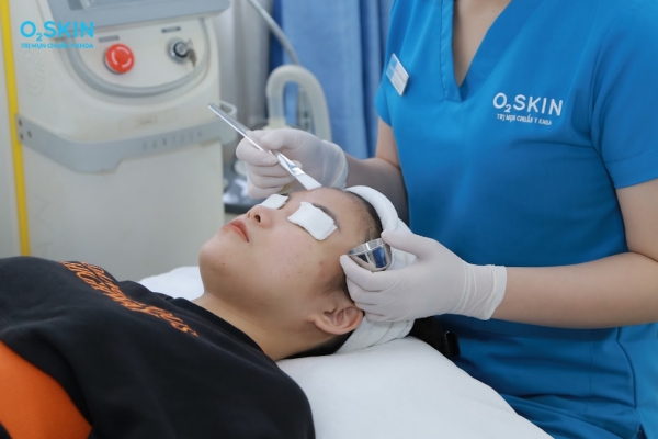 Peel da trị mụn bọc mủ