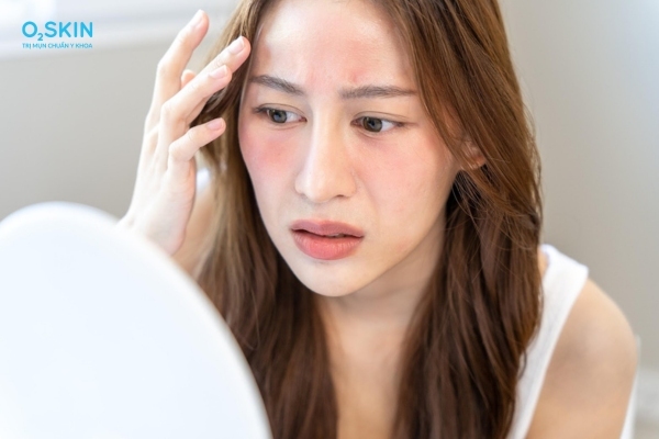 Mụn trứng cá bị ngứa do đâu