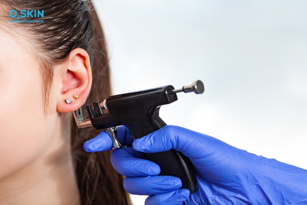 Nổi mụn bọc ở vành tai do đâu