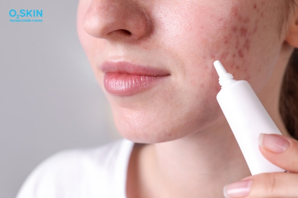 Cơ chế hoạt động của kháng sinh mụn trứng cá