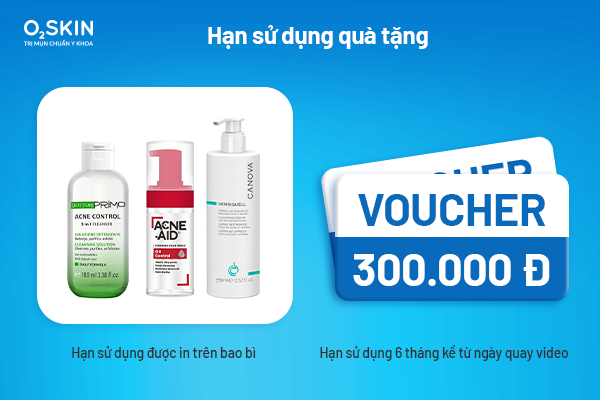 Hạn sử dụng quà tặng