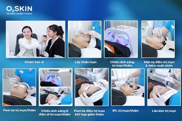 Điều trị mụn áp xe