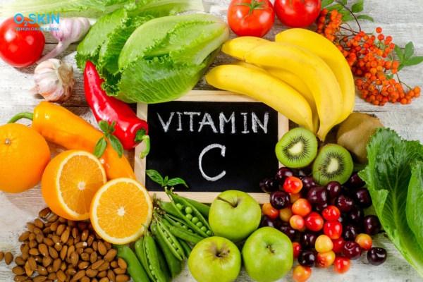Da mụn có nên dùng vitamin C
