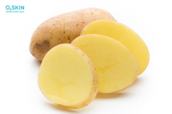 Khoai tây trị mụn được không