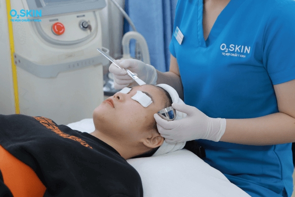 Lưu ý khi trị mụn đầu đen bằng mật ong