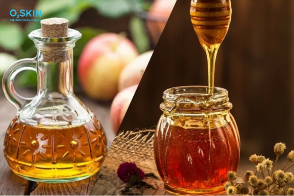 Trị mụn đầu đen bằng mật ong tại nhà