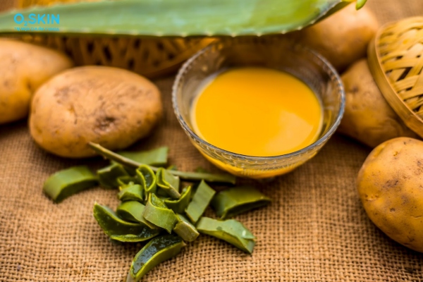 Trị mụn trứng cá bằng khoai tây với nha đam