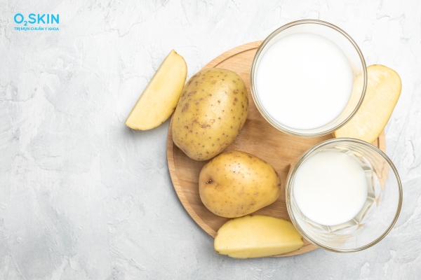Trị mụn trứng cá bằng khoai tây và sữa tươi
