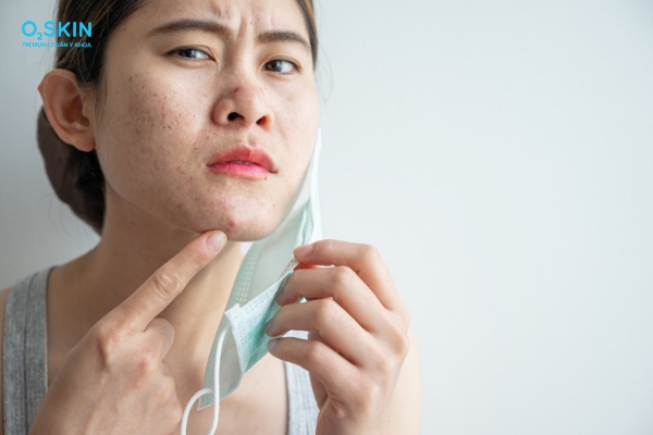 Bao nhiêu tuổi thì hết mụn