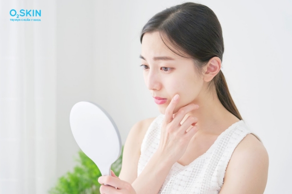 Chăm sóc da sau nặn mụn