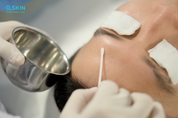 Phòng tránh peel da nổi mụn nước