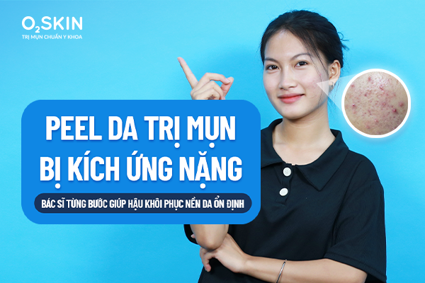 Peel da trị mụn bị kích ứng nặng: Bác sĩ từng bước giúp Hậu khôi phục nền da ổn định