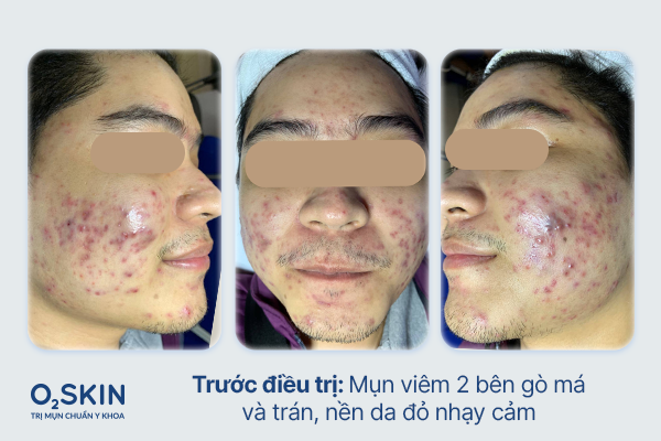 Cận cảnh làn da của Tuấn Tú trong lần thăm khám đầu tiên