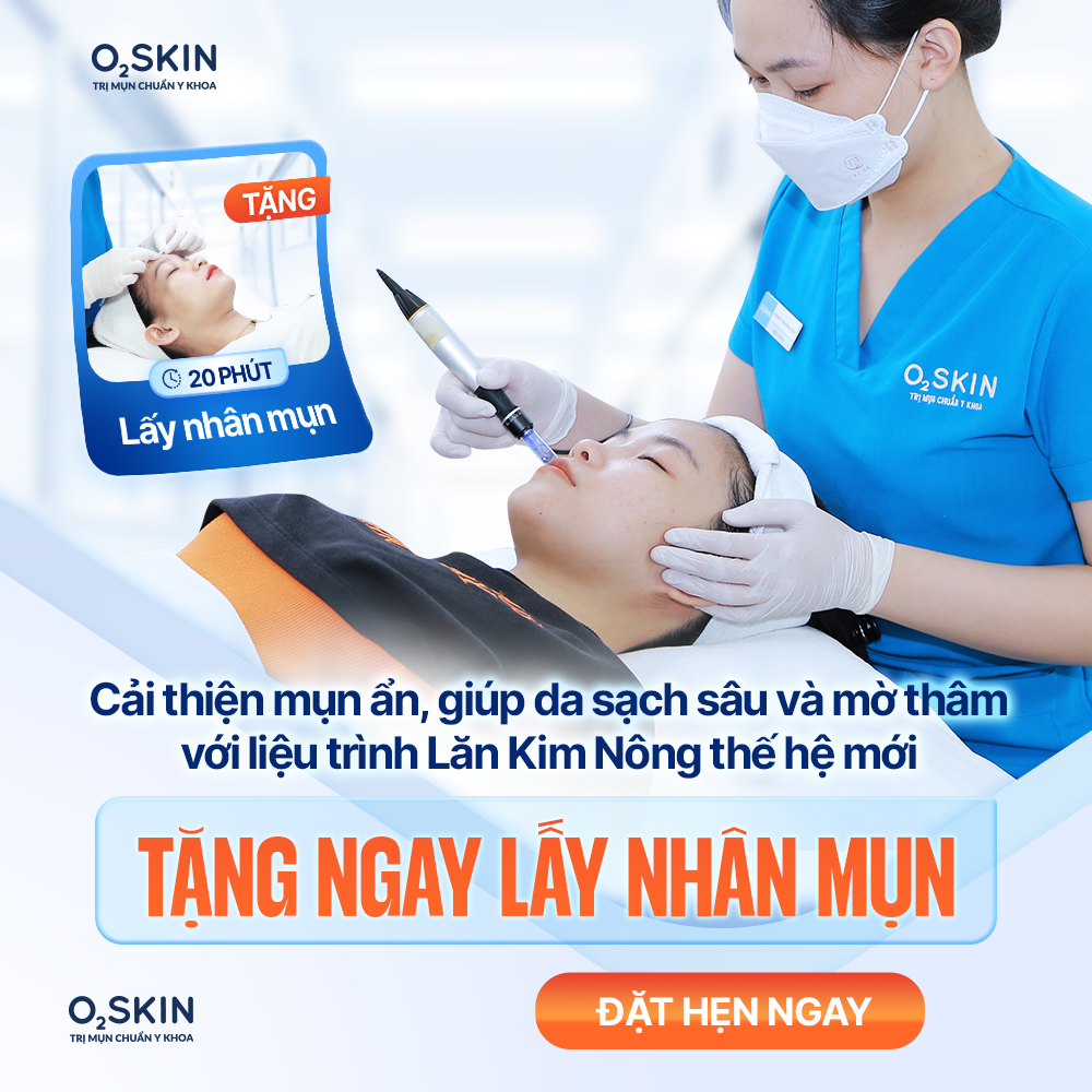 Lăn kim nông + Lấy nhân mụn giúp làm sạch sâu và mờ thâm Lăn kim nông + Lấy nhân mụn giúp làm sạch sâu và mờ thâm