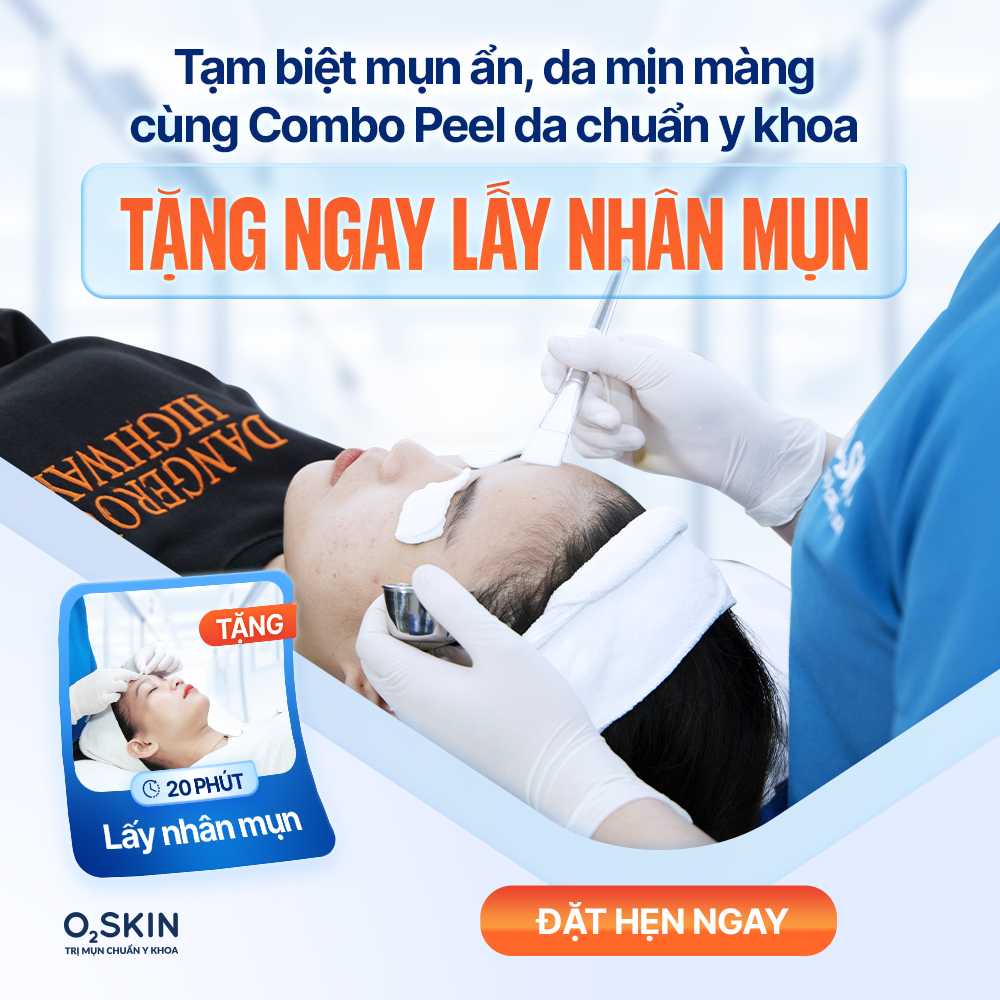 Peel da + Lấy nhân mụn giảm độ sần và giảm bít tắc