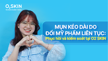 Mụn kéo dài do đổi mỹ phẩm liên tục: Cách phục hồi da sau 14 tuần