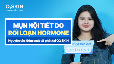 Mụn nội tiết do rối loạn hormone và nguyên tắc kiểm soát tái phát tại O2 SKIN