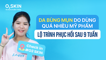 Da bùng mụn do dùng quá nhiều mỹ phẩm: Lộ trình phục hồi sau 9 tuần
